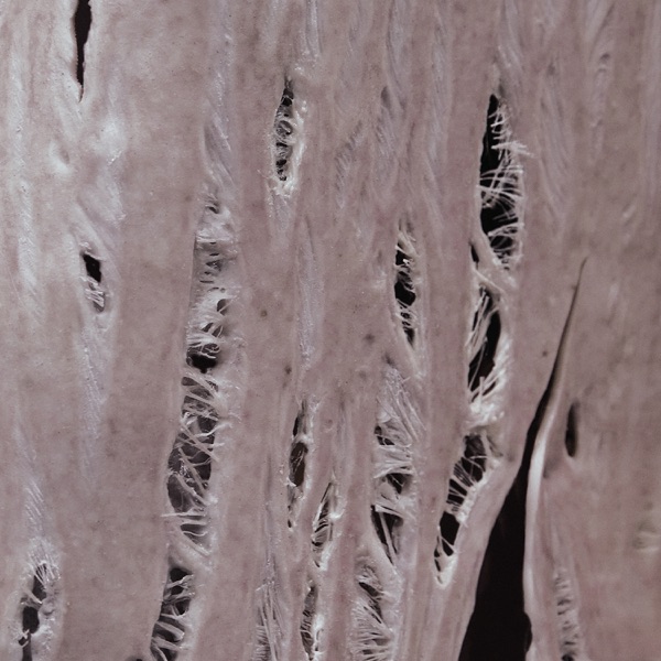 Torn
