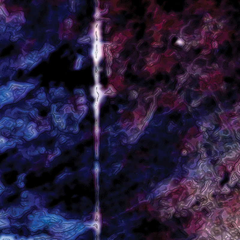 Theoretically pure anterograde amnesia