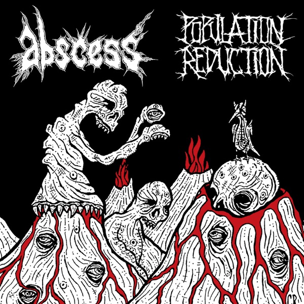 Abscess / Population Reduction