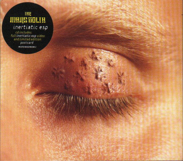 Inertiatic ESP