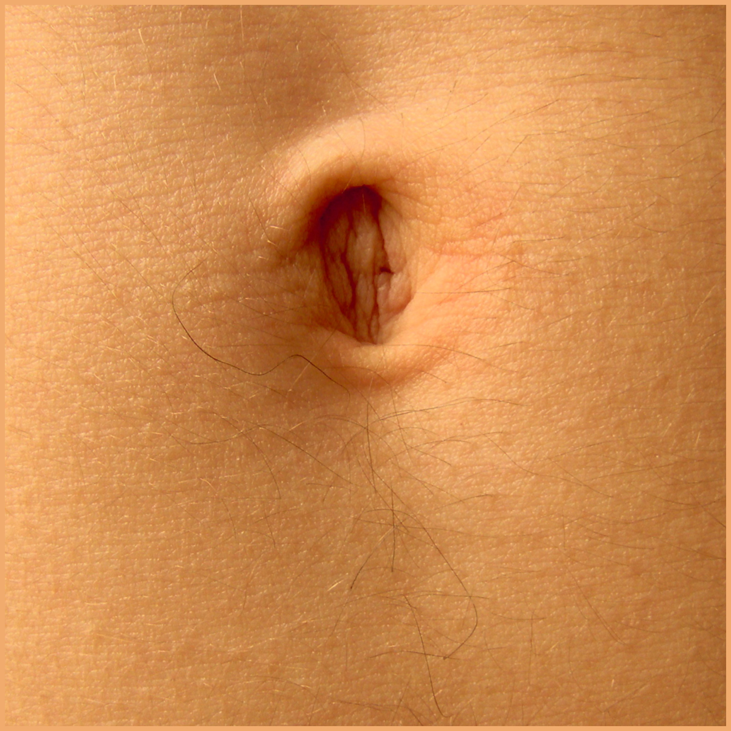 [Uterus]