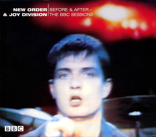 Before & After – The BBC Sessions